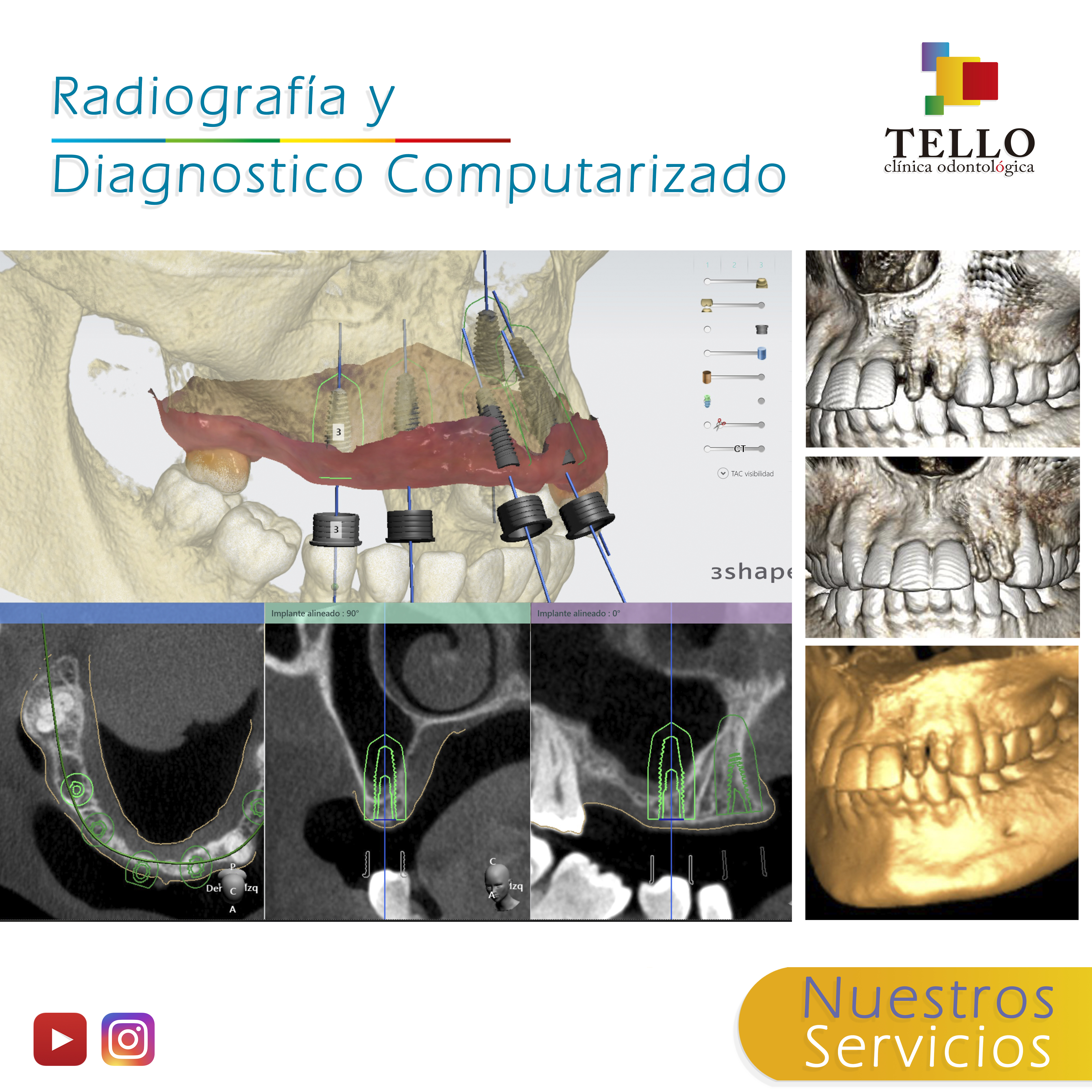 Diagnóstico computarizado tomografía tridimensional Tello Odontología Cochabamba