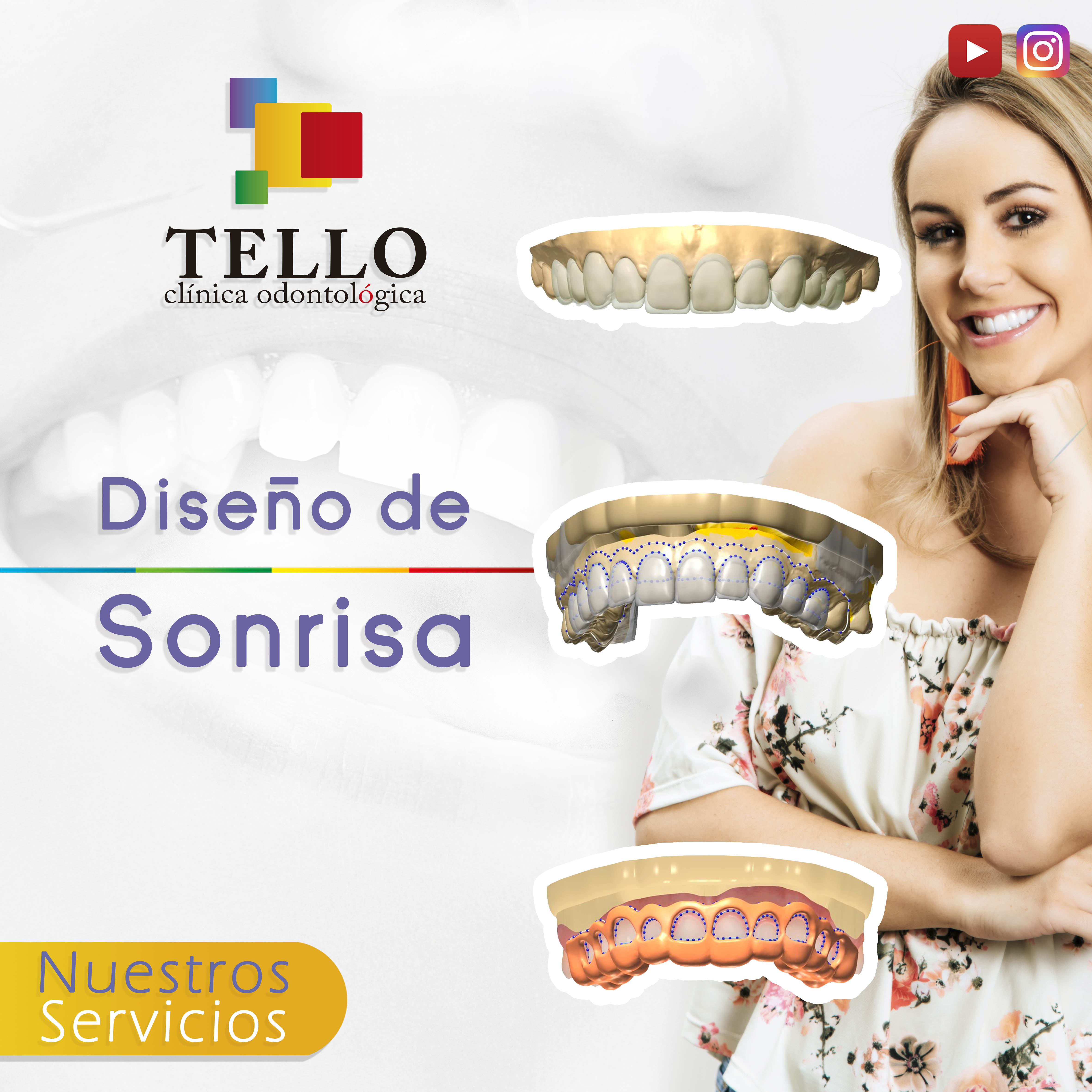 Diseño de sonrisa y armonización Tello Odontología Cochabamba