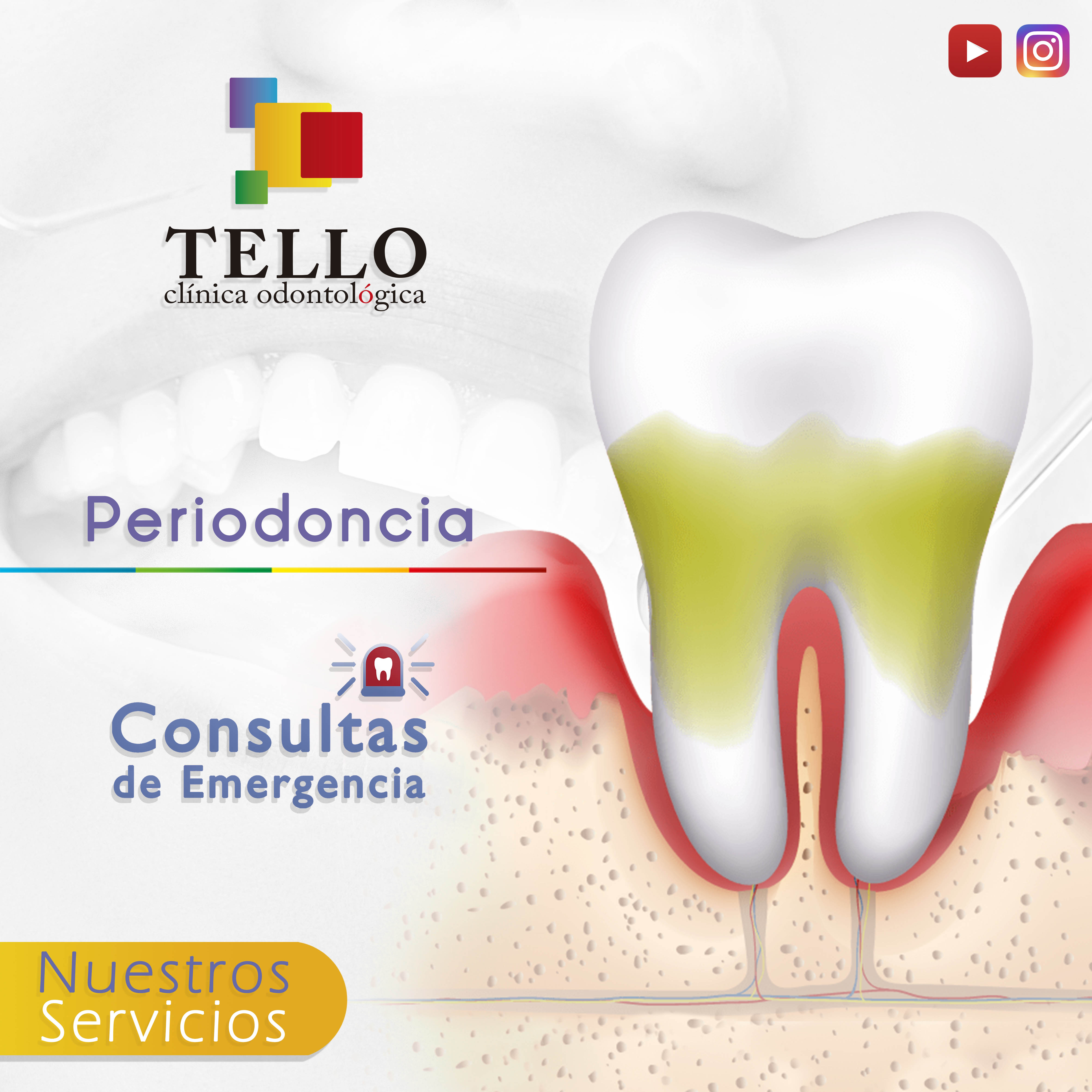 Periodoncia Tello Odontología