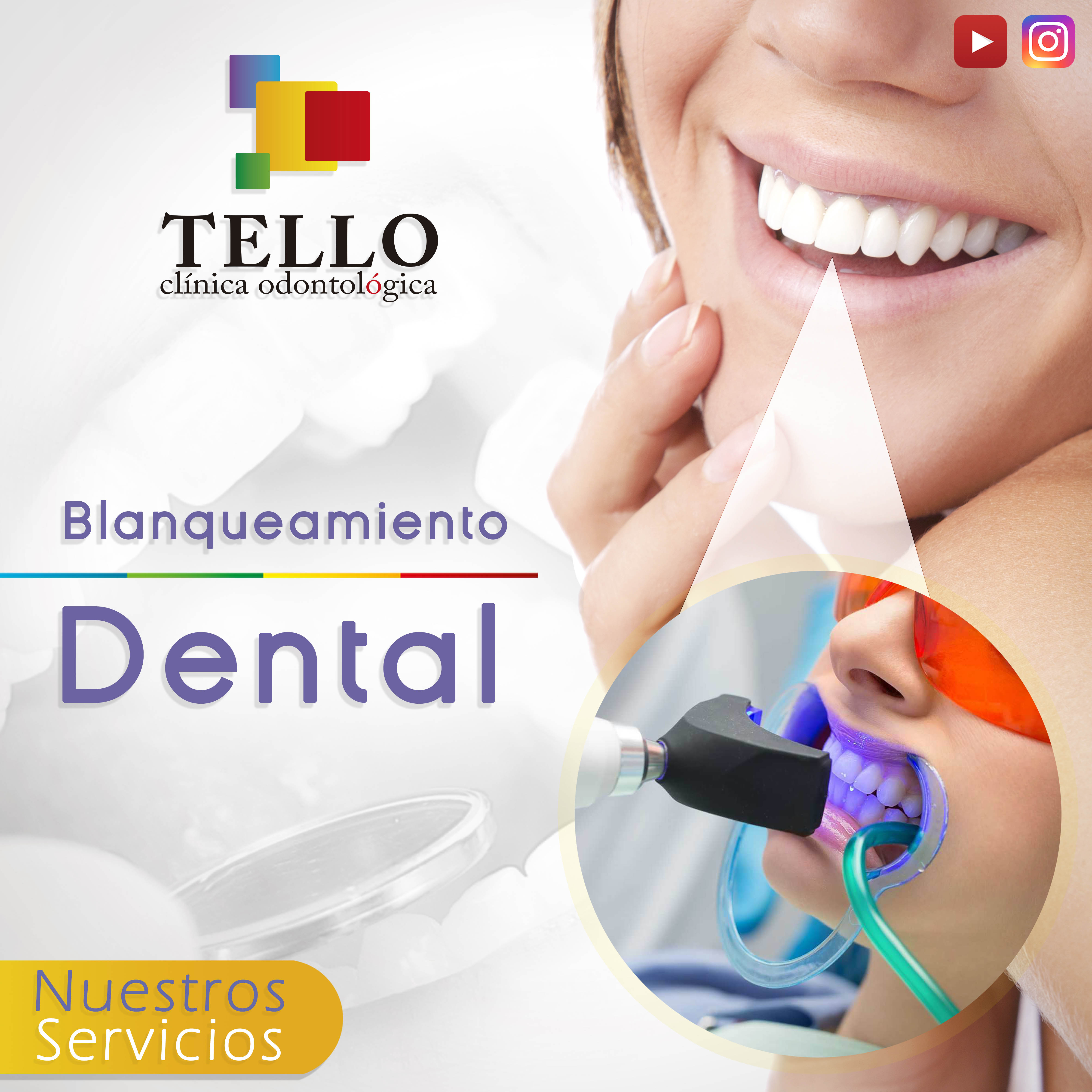 Blanqueamiento dental Tello Odontología